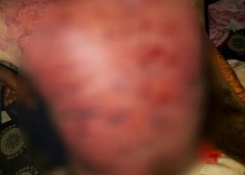 Ciwanekî Efrînê dema daxwaza mal û milkê xwe li çeteyan kir rastî eşkencê hat