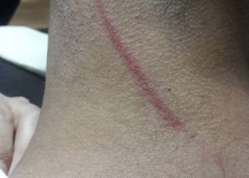 Ciwanê HDP’î , aliyê polîsan ve hat binçavkirin û rastî lêdanê hat