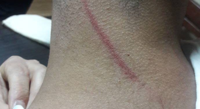 Ciwanê HDP’î , aliyê polîsan ve hat binçavkirin û rastî lêdanê hat