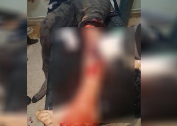 Leşkerên Dagirker li Amûd’ê sîvîlekî birîndar kir