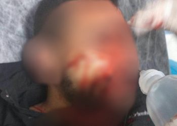 LEZGÎN – Li Ezazê li MÎT’ê hate xistin