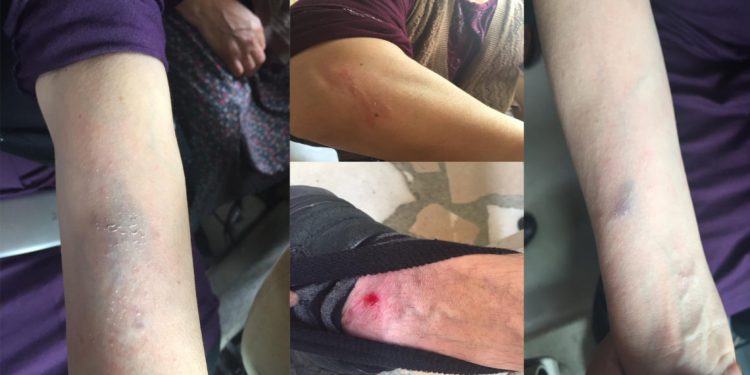 Li Gebzeyê di êrîşê de polîsên Tirk ên dagirker gelek dayik birîndar kiribûn