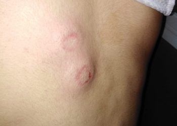 Ciwanên ku li Êlih’ê hatin binçavkirin di nav wesayîtên polîsan de tên seknandin