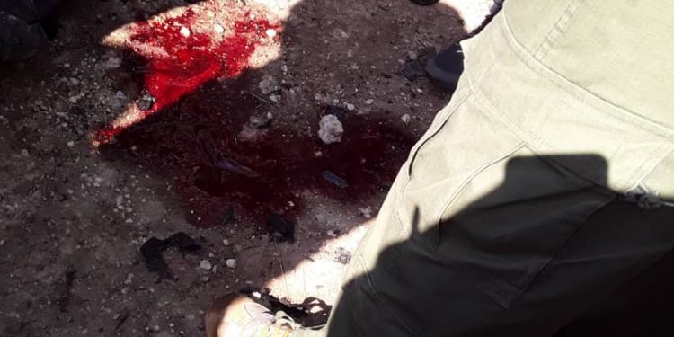 Li Qamişlo çeteyek xwe teqand: 2 kes birîndar bûn