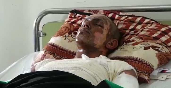 Birîndarên li Hesekê: Dewleta tirk a dagirker bi fosforê êrîşî me kir