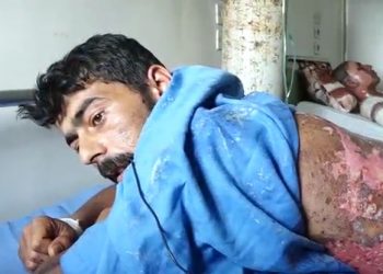 Birîndarên li Hesekê: Dewleta tirk a dagirker bi fosforê êrîşî me kir