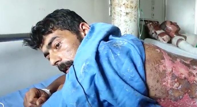 Birîndarên li Hesekê: Dewleta tirk a dagirker bi fosforê êrîşî me kir