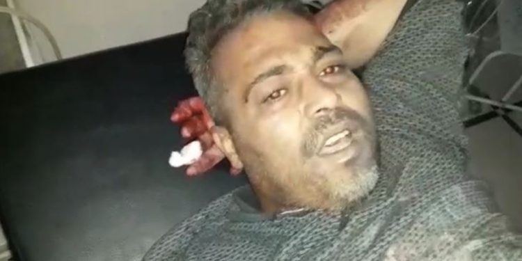 Mayina dagirkeran teqiya, kesek bi giranî birîndar bû!