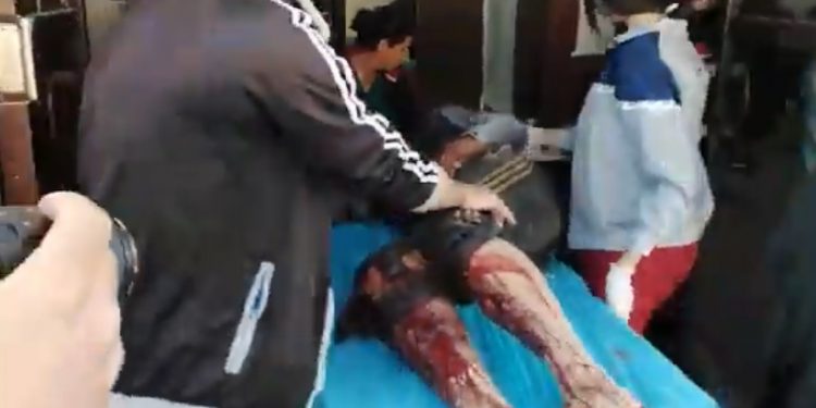 Mayîna çeteyan li gundê Reyhaniyê yê navçeya Til Temrê teqîn: 2 sivîl birîndar bûn