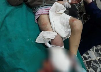 Artêşa Tirk a dagirker li Til Rifetê komkujî pêk anî, 9 zarok-sivîl şehîd bûn