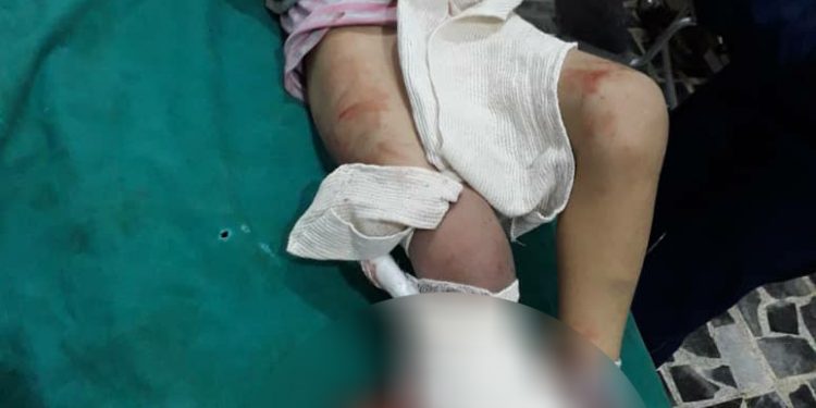 Artêşa Tirk a dagirker li Til Rifetê komkujî pêk anî, 9 zarok-sivîl şehîd bûn