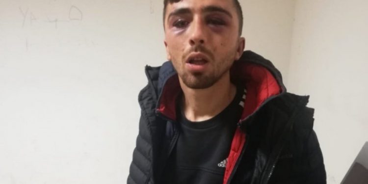 Di nezaretê de êşkence lê hate kirin