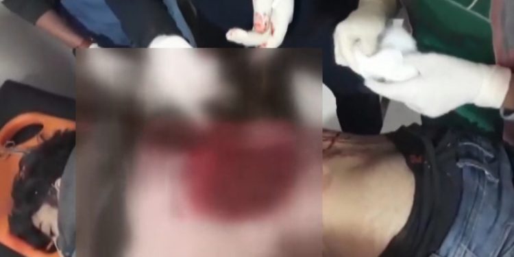 Balafirên şer li gundê Seyda 3 sivîl birîndar kirin