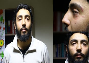 Xwendekarê Zanîngehê rastî êrîşa nijatperest hat