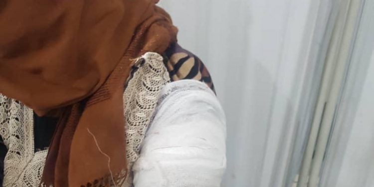 Di êrîşa li dijî Eyn Îsayê de 4 sivîl birîndar bûn