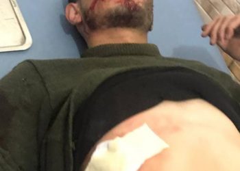 Artêşa Tirk a dagirker gundê Eboş bombe kir: 2 leşkerên rejîmê mirin