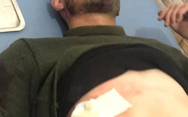 Artêşa Tirk a dagirker gundê Eboş bombe kir: 2 leşkerên rejîmê mirin