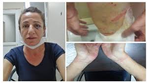 Sevîl Rojbîn Çetîn girtin!