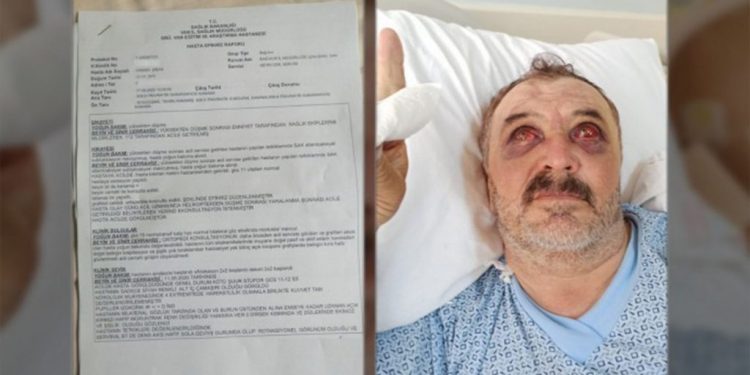 Servet Tûrgût ê ji helîkopterê hat avêtin 17 roj in di beşa lênêrîna awarte de ye!