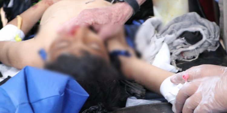 Zarokê ku li Eyn Îsayê birîndar bûbû jiyana xwe ji dest da