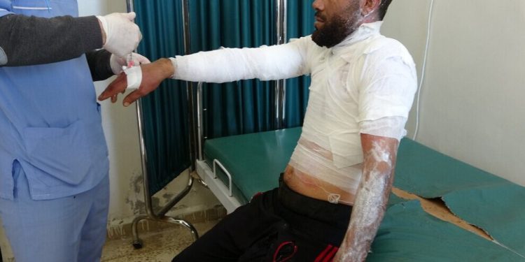 Li Dêrîkê li dijî salvegera komployê ciwanekî bedena xwe da ber agir