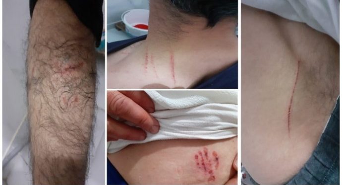 Polîs eşkere kir: Kuçikê ku erîşê malbatê kir nas derket – Hevalê Sulêman Soylu ye!