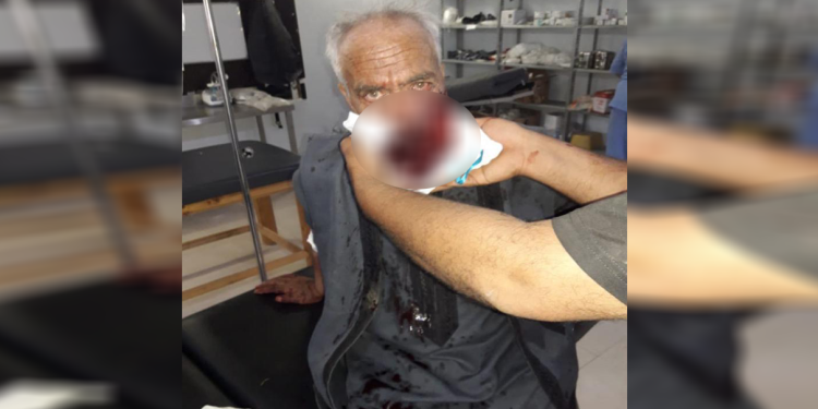 Zilma artêşa Tirk ya li ser gelê Ereb – Vê kesê jiyana xwe ji dest da!