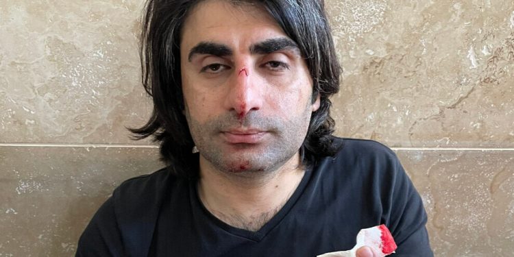 Polîsên faşîst aşkere îşkence dikin – Edliyê de pozê parêzer şikandin!