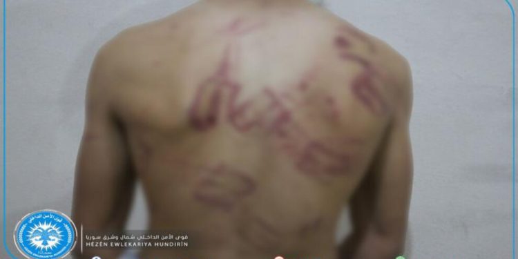 Dewleta Tirk a dagirker li ser sînorê Kobanê îşkence 3 ciwanan kir