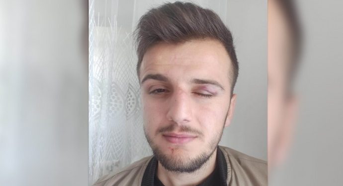 Li Çewligê eşkiyatiya polîsan – Ciwanên Kurd dan û xwestin lê îşareta faşîstan bidin kirin