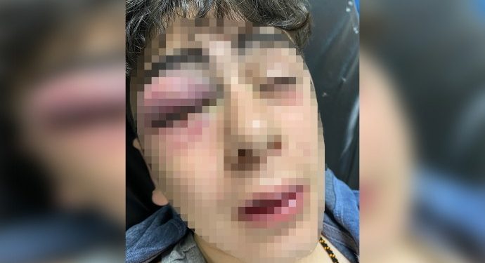 Dewleta dagirker li Amedê zarokeke ya 14 salî işkence kir û ferz kir ku bibejê ‘Ez Tirk im’