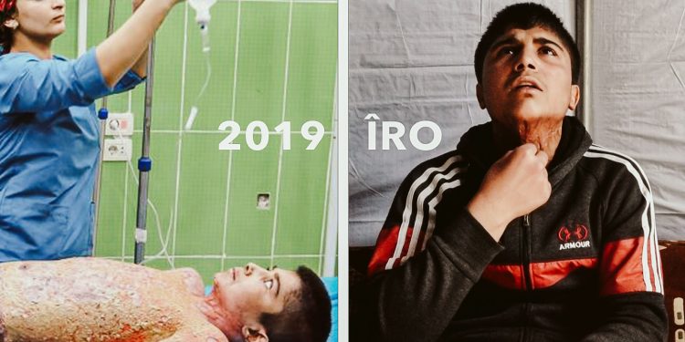 Salvegera dagirkirinê Serêkaniyê: “Canê min gelek şewitî”