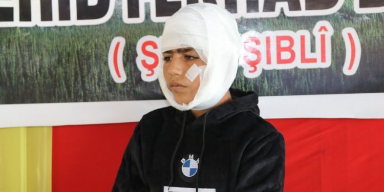 Zarokê birîndar ji bin konê sersaxiyê peyamek da dijmin