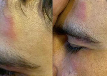 Komeke ‘ulkucî’ êrişî xwendekarekî kirin