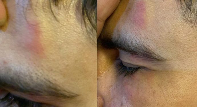 Komeke ‘ulkucî’ êrişî xwendekarekî kirin