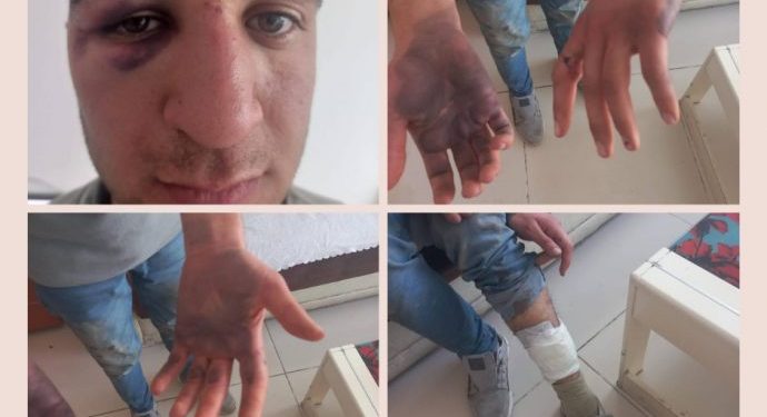 Bertek li hemberî îşkenceya li Gezîcî: Ev wêne mînaka nêrîna dewletê ya li ser Kurdan e