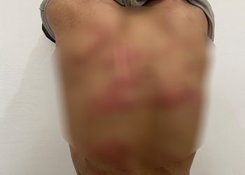 Eskerên Tirk 2 zarok di nav de 8 ciwan îşkence kir