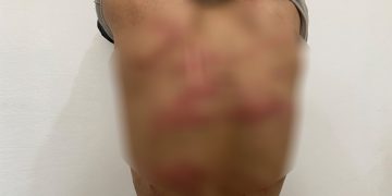 Eskerên Tirk 2 zarok di nav de 8 ciwan îşkence kir