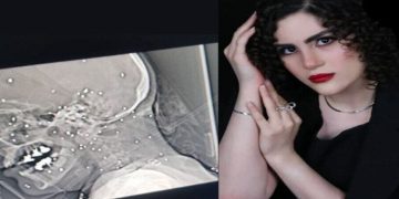 Li Îranê Jinek Ciwan Hate Kuştin