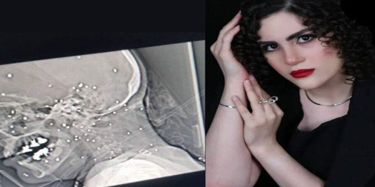 Li Îranê Jinek Ciwan Hate Kuştin