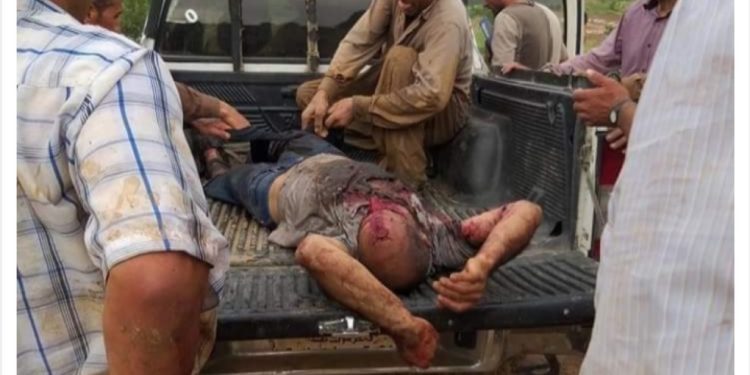 İşgalci Türk ordusuna ait mayın patladı: Bir yurttaş yaralandı