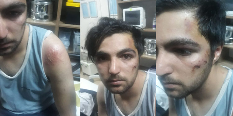 Agirî’de gözaltında işkence