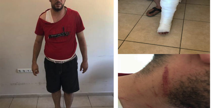 İşgalci Türk polisi şehit ailesine saldırdı!