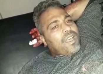 İşgalcilerin sivil halka yönelik işkencelerine bir yenisi eklendi