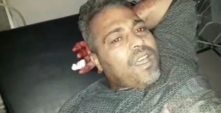 İşgalcilerin sivil halka yönelik işkencelerine bir yenisi eklendi