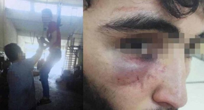 Çocuk işçi vida numarasını unuttuğu için tavana asıldı