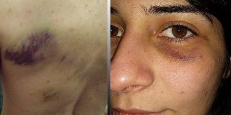 Gazi Mahallesi Karakolu’nda iki gence işkence!