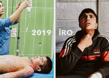 Muhammed Hemid: Canım çok yandı