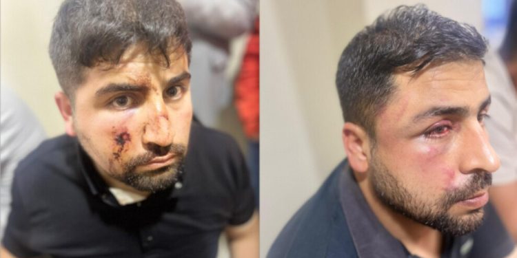 Yıkıma itiraz eden 104 kişiye polis işkencesi