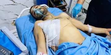 İşgalci Türk devleti Kobanê’de tarlasını sulayan bir yurttaşı bombaladı